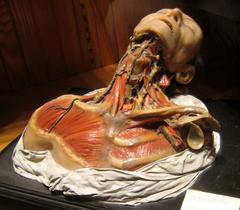 Anatomical wax model showcasing a throat condition at Mütter Museum