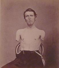 Alfred A. Stratton portrait without arms