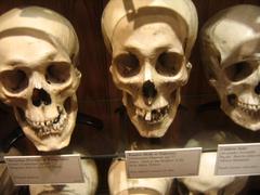 Mütter Museum display with various human skulls and medical specimens