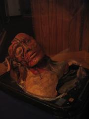 Half-asleep figurine displayed at Mütter Museum