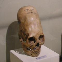 Skull on display at Museo Regional de Ica in Peru