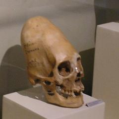 Paracas skull on display at Museo Regional de Ica