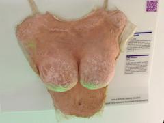 fake breasts display at the Museum of Broken Relationships