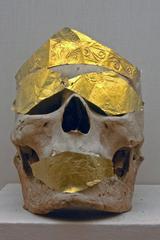 skull with gold-covered eyes and mouth