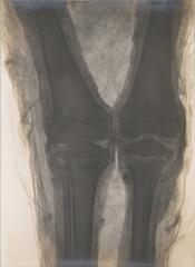 X-ray image of child mummy knees