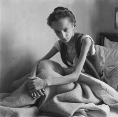 Emaciated woman in bed looking at the camera at Bergen-Belsen concentration camp in 1945