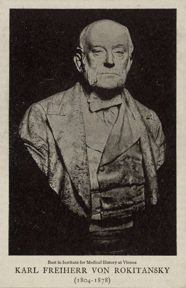 Bust of Karl Freiherr von Rokitansky