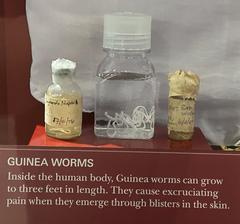 Guinea worms on display in Jimmy Carter Library and Museum