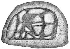 The Black Stone set in the Kaaba wall in 1658