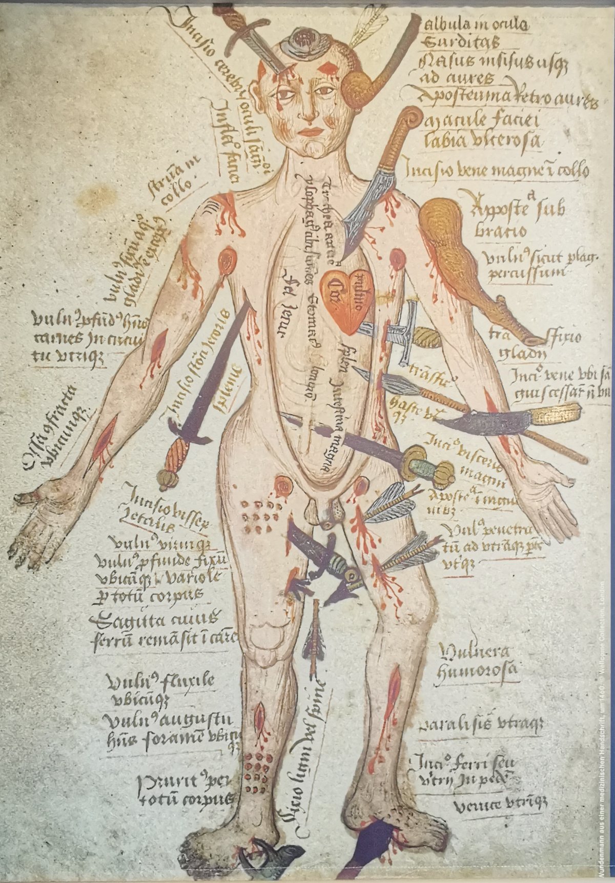Illustration of the 'Wundenmann' from the Feldbuch der Wundarznei by Hans von Gersdorff, 1517, at Kaiserburg-Museum Nürnberg