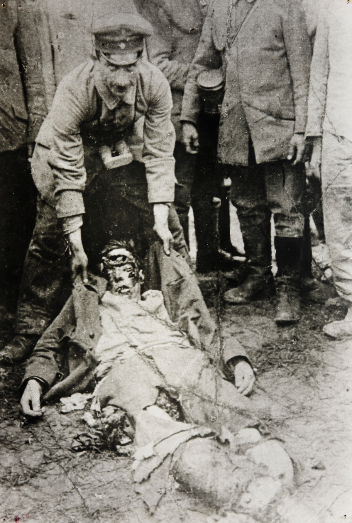 Dead soldier in World War I photographed for League of Nations archives